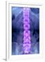 Normal Lumbar Spine, X-ray-Du Cane Medical-Framed Photographic Print