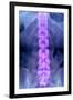 Normal Lumbar Spine, X-ray-Du Cane Medical-Framed Photographic Print