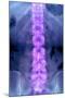 Normal Lumbar Spine, X-ray-Du Cane Medical-Mounted Photographic Print