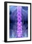 Normal Lumbar Spine, X-ray-Du Cane Medical-Framed Photographic Print