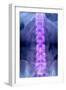 Normal Lumbar Spine, X-ray-Du Cane Medical-Framed Photographic Print