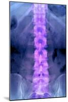 Normal Lumbar Spine, X-ray-Du Cane Medical-Mounted Photographic Print