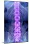 Normal Lumbar Spine, X-ray-Du Cane Medical-Mounted Photographic Print