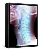 Normal Neck, X-ray-Du Cane Medical-Framed Stretched Canvas
