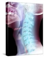 Normal Neck, X-ray-Du Cane Medical-Stretched Canvas