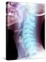 Normal Neck, X-ray-Du Cane Medical-Stretched Canvas