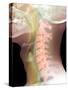 Normal Neck, X-ray-Du Cane Medical-Stretched Canvas