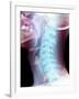 Normal Neck, X-ray-Du Cane Medical-Framed Photographic Print