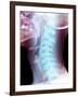 Normal Neck, X-ray-Du Cane Medical-Framed Photographic Print