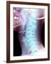 Normal Neck, X-ray-Du Cane Medical-Framed Photographic Print