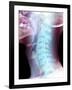 Normal Neck, X-ray-Du Cane Medical-Framed Photographic Print