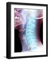 Normal Neck, X-ray-Du Cane Medical-Framed Photographic Print