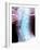 Normal Neck, X-ray-Du Cane Medical-Framed Photographic Print