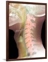 Normal Neck, X-ray-Du Cane Medical-Framed Photographic Print