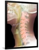 Normal Neck, X-ray-Du Cane Medical-Framed Photographic Print