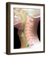 Normal Neck, X-ray-Du Cane Medical-Framed Photographic Print