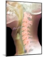 Normal Neck, X-ray-Du Cane Medical-Mounted Photographic Print