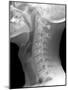 Normal Neck, X-ray-Du Cane Medical-Mounted Photographic Print