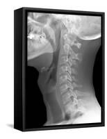 Normal Neck, X-ray-Du Cane Medical-Framed Stretched Canvas