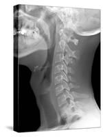 Normal Neck, X-ray-Du Cane Medical-Stretched Canvas