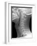 Normal Neck, X-ray-Du Cane Medical-Framed Photographic Print