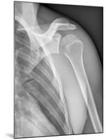 Normal Shoulder, X-ray-ZEPHYR-Mounted Photographic Print