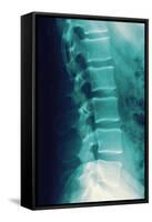Normal Spine, X-ray-Miriam Maslo-Framed Stretched Canvas