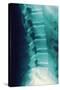 Normal Spine, X-ray-Miriam Maslo-Stretched Canvas