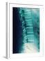 Normal Spine, X-ray-Miriam Maslo-Framed Premium Photographic Print