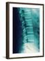 Normal Spine, X-ray-Miriam Maslo-Framed Premium Photographic Print