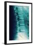 Normal Spine, X-ray-Miriam Maslo-Framed Premium Photographic Print