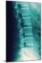 Normal Spine, X-ray-Miriam Maslo-Mounted Premium Photographic Print