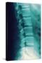 Normal Spine, X-ray-Miriam Maslo-Stretched Canvas