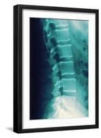 Normal Spine, X-ray-Miriam Maslo-Framed Photographic Print