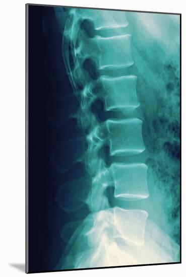 Normal Spine, X-ray-Miriam Maslo-Mounted Photographic Print