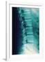 Normal Spine, X-ray-Miriam Maslo-Framed Photographic Print