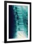 Normal Spine, X-ray-Miriam Maslo-Framed Photographic Print