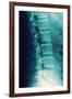 Normal Spine, X-ray-Miriam Maslo-Framed Photographic Print