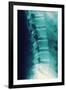 Normal Spine, X-ray-Miriam Maslo-Framed Photographic Print