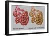 Normal vs. Emphysematous Alveoli-Gwen Shockey-Framed Giclee Print