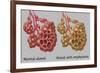 Normal vs. Emphysematous Alveoli-Gwen Shockey-Framed Giclee Print