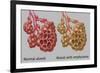 Normal vs. Emphysematous Alveoli-Gwen Shockey-Framed Giclee Print