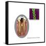 Oral Infection of Streptococcus Oralis-Gwen Shockey-Framed Stretched Canvas