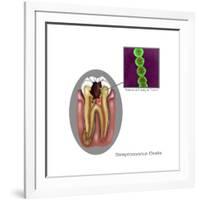 Oral Infection of Streptococcus Oralis-Gwen Shockey-Framed Art Print