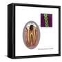 Oral Infection of Streptococcus Oralis-Gwen Shockey-Framed Stretched Canvas