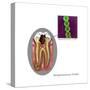 Oral Infection of Streptococcus Oralis-Gwen Shockey-Stretched Canvas