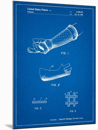 Orthopedic Hard Cast Patent-Cole Borders-Mounted Art Print