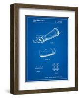 Orthopedic Hard Cast Patent-Cole Borders-Framed Art Print
