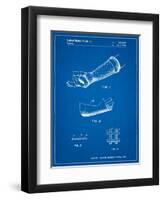 Orthopedic Hard Cast Patent-Cole Borders-Framed Art Print