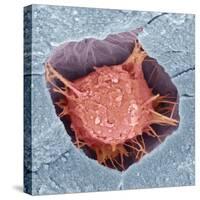 Osteoblast Bone Cell, SEM-Steve Gschmeissner-Stretched Canvas